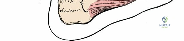 Orthopaedic Infections: Etiology, Prophylaxis, and Diagnostic Modalities