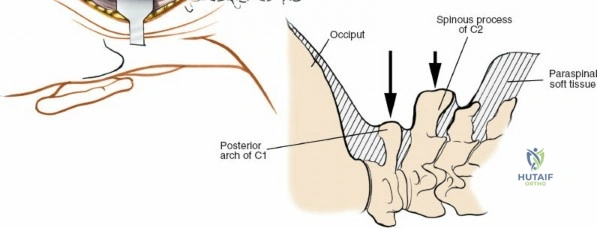 Illustration of correct answer b figures - Dr. Mohammed Hutaif