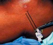 Clinical Image