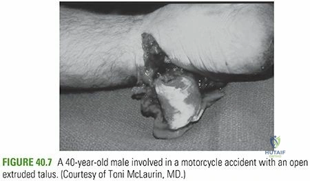 Clinical Image