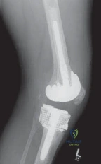 Clinical Image