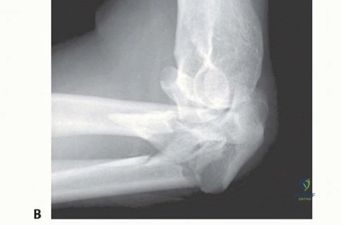 Clinical Image
