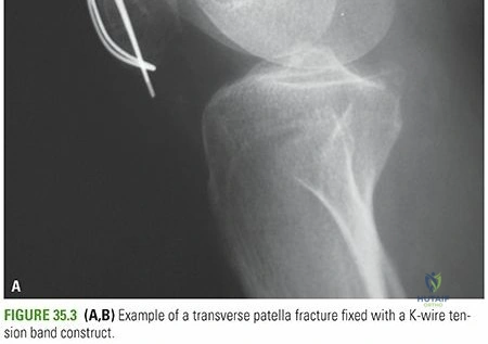 Clinical Image