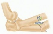 Clinical Image