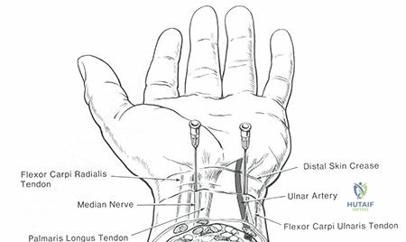 Clinical Image
