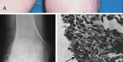 Clinical Image