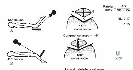 Clinical Image