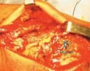 Clinical Image