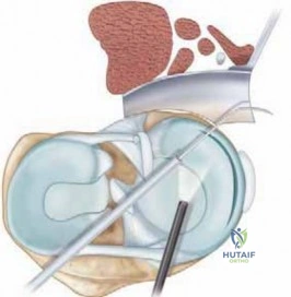 Clinical Image