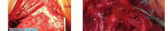 Clinical Image