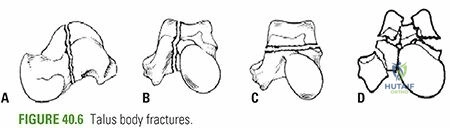 Clinical Image