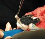 Clinical Image