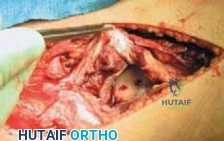 Clinical Image