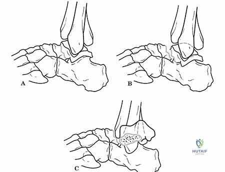 Clinical Image