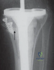 Clinical Image