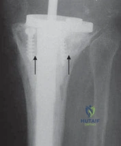 Clinical Image