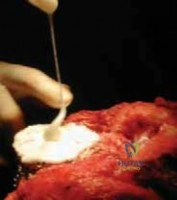 Clinical Image