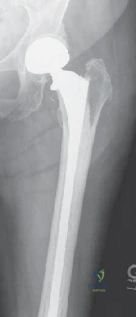 Clinical Image