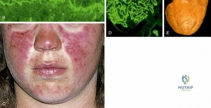 Clinical Image