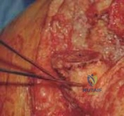 Clinical Image