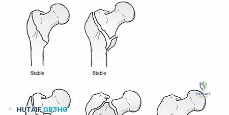 Clinical Image