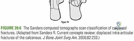 Clinical Image