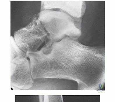 Clinical Image
