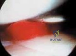 Clinical Image