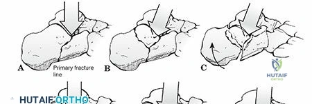 Clinical Image