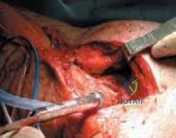 Clinical Image