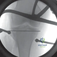Clinical Image