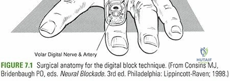 Clinical Image