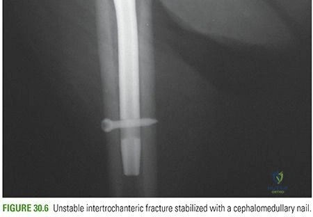 Clinical Image