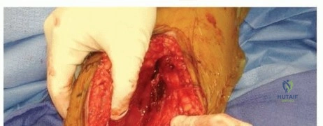 Clinical Image