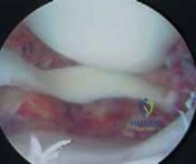 Clinical Image