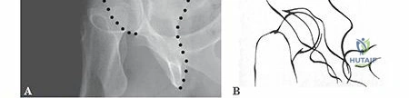 Clinical Image