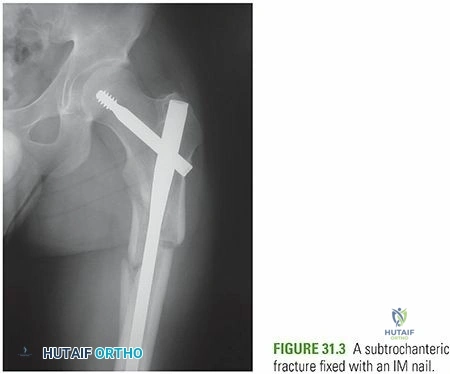 Clinical Image