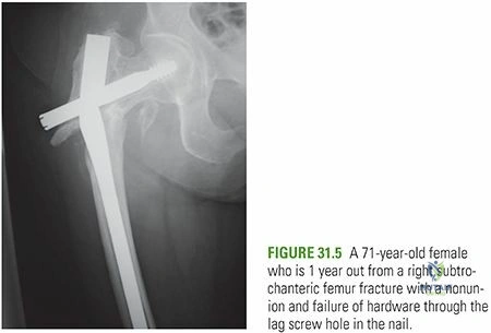 Clinical Image