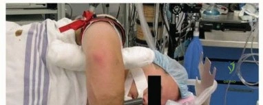 Clinical Image
