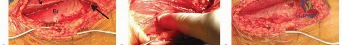 Clinical Image