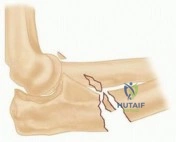 Clinical Image