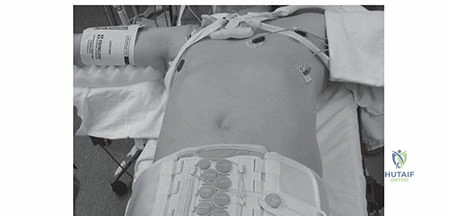 Clinical Image