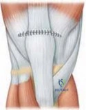 Clinical Image
