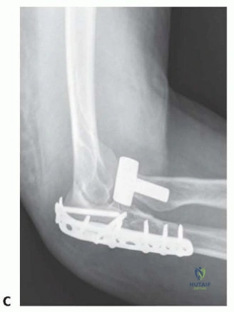 Clinical Image