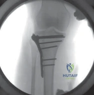 Clinical Image