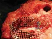 Clinical Image