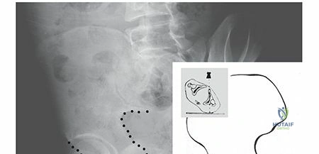 Clinical Image