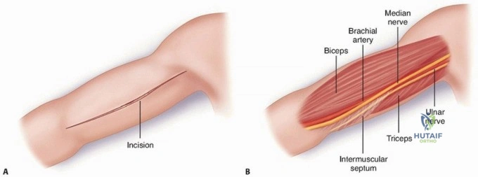 Clinical Image