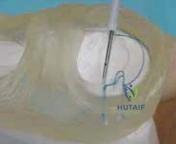 Clinical Image