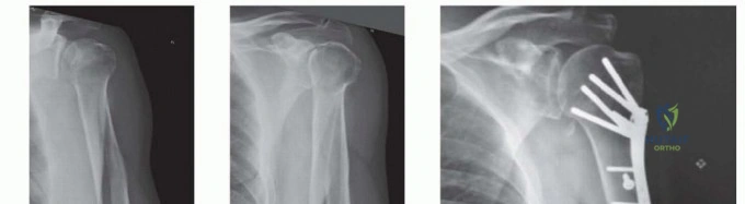 Clinical Image